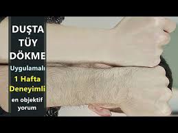 Dusta Tuylerinizden Kurtulun Uygulamali Ve 1 Haftalik Sonuc Aras Barlas Youtube