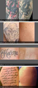 Explore other popular beauty & spas near you from over 7 million businesses with over 142 million reviews and opinions from yelpers. Tattoo Removal Los Angeles Signature Med Spa By Su Sachar Mdsachar Signature Med Spa