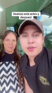 Antes y después que a todos nos escanea ver