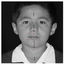 Redalyc.EXTRACCIÓN DE PUNTOS CARACTERÍSTICOS DEL ROSTRO PARA MEDIDAS  ANTROPOMÉTRICAS