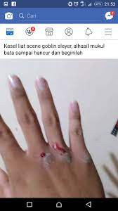 Ia ingin segera bobo kembali. 30 Foto Tangan Berdarah Mukul Tembok Terbaru Riwayat Gallery