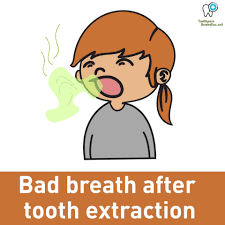 Why Do I Get Bad Breath After Tooth Pulled The Bad Breath After Tooth Extraction Is Quite A Significant Tooth Extraction Bad Breath Cure Causes Of Bad Breath