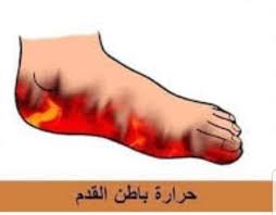 كل يوم معلومة حرارة القدمين تعتبر حرارة القدمين من facebook