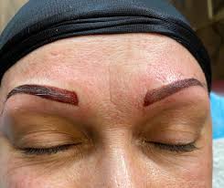 Tattoo vanish is all natural; Different Options For Cosmetic Tattoo Removal