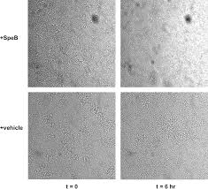 Check spelling or type a new query. The Streptococcal Protease Speb Antagonizes The Biofilms Of The Human Pathogen Staphylococcus Aureus Usa300 Through Cleavage Of The Staphylococcal Sdrc Protein Journal Of Bacteriology