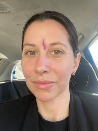 Are there film projects available for an actor with a real injury?