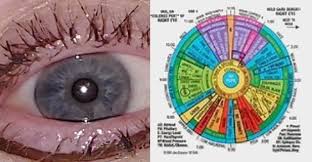 Myth Or Fact Can Iridology Detect Systemic Disease