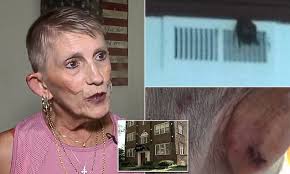 Kansas City woman says she is being bitten by BATS in her apartment
