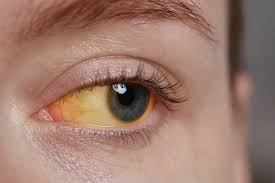 Image result for Sclera