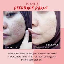 Cara ni boleh hilangkan parut berlubang hello! Tips Rawatan Parut Berlubang Tanpa Laser T9 Skincare