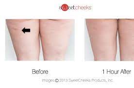 SweetCheeks Cellulite Massage Mat 