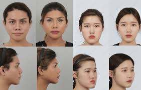 All surgical procedures come with some amount of risk and must be treated as such. Id Hospital In Korea Prices For Diagnosis And Treatment Reviews Mediglobus
