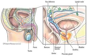 Most men with early prostate cancer don't. Patient Resource Publishing Advanced Prostate Overview