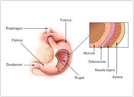 When signs and symptoms aren't apparent or go ignored, the disease generally reaches more advanced stages before being properly diagnosed. Stomach Cancer Symptoms Modern Cancer Hospital Guangzhou China