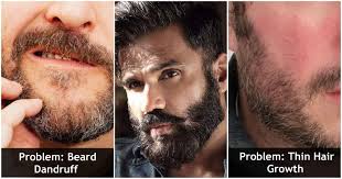 This men's facial hair style is usually just a step up in length from stubble. Types Of Beard Problems That Men Face How To Deal With Them News Chant