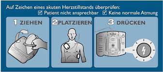 Hilfe Bei Der Evaluation Des Passenden Laien Defibrillator Aed Rettungskette