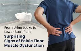 Image result for Pelvic Floor Dysfunction