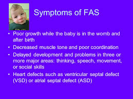 Fetal Alcohol Effects Ppt Download
