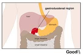 Acid reflux or acid indigestion is a common digestive disorder that generally occurs when the stomach acid or its content flows back into the esophagus. Stomach Pain And Bloating Causes And Treatments For Indigestion Dyspepsia Goodrx