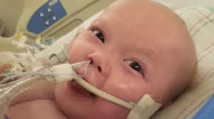 Community supports family of baby who had open-heart surgery