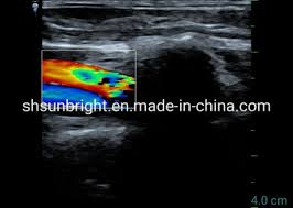 Doctors use the scans to diagnose a range of issues. China 128 Elements Color Doppler Ultrasound Type C Usb Linear Probe China Probe Usb Probe