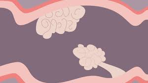 Vomiting, with or without blood. Early Signs Of Colon Cancer 5 Colorectal Cancer Warning Signs
