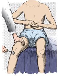 Image result for Supinator Reflex