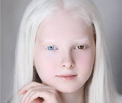 オッドアイとアルビノ、2つのスペシャルを持って生まれたチェチェンの美しい少女（ロシア） (2020年5月16日) - エキサイトニュース