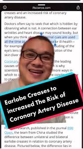 Earlobe Creases to increased The Risk of Coronary Artery Disease  #centreofbalance #acupunctureclinichamilton #coronaryarterydisease