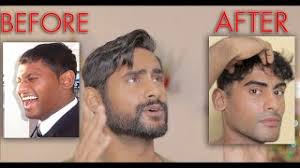 Can Chewing Gum Help Your Jawline Simple Gum Technique For A Better Jawline Youtube