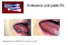 Image result for Aphthasol