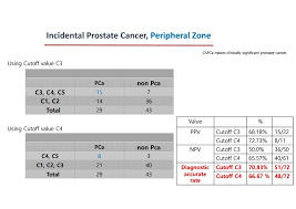 Here are 10 more facts about prostate cancer. Epos Trade