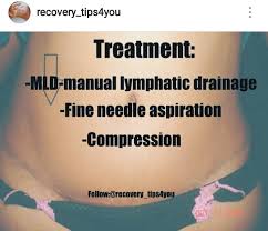 A Seroma Is A Liquid Swishing Around In The Stomach N Needs To Be Treated Asap Chirurgie