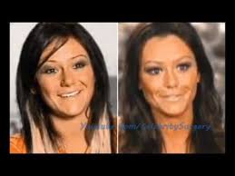 Find out more returning comedy. Jwoww Plastic Surgery Before And After Youtube