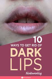 How To Lighten Dark Lips 7 Home Remedies Natural Lip Scrub Dark Lips Lip Lightening