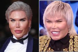 Ask anything you want to learn about jessica alves by getting answers on askfm. Human Ken Doll Rodrigo Alves I M Sinking After 11 Nose Jobs