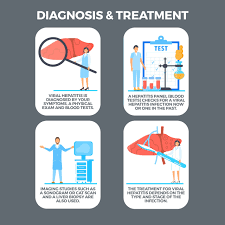 Image result for hepatitis symptoms