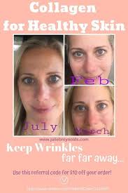 We would like to show you a description here but the site won't allow us. 110 Best Collagen Before And After Ideas In 2021 Collagen Collagen Before And After Skin