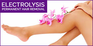 electrolysis hair removal in ilford