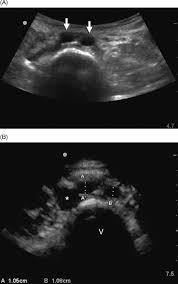 (figure continues on page 360.) 360 essentials of human anatomy and physiology (oxygen enters the blood and carbon dioxide enters the lungs) and then return it to the heart. Abdominal Aorta Ultrasound Chapter 5 Manual Of Emergency And Critical Care Ultrasound