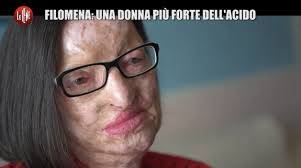 Quando applicato sulla pelle, infatti, l'acido salicilico esplica una potente azione cheratolitica, poiché è in grado di spezzare selettivamente. Video Filomena Sfregiata Con L Acido Dal Marito L Ha Voluto Lei Lo Rifarei