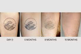 So why are tattoos permanent when skin is supposedly continually regenerating? How Ephemeral Tattoo S Semi Permanent Ink Works Rakawc