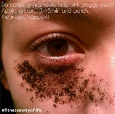 Bye Bye Puffy Eyes Hello Fresh Face Beauty Hacks Beauty Remedies Puffy Eyes