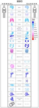 •the cancer is found in an age group in which it is not usually found. Cancer Stem Cells And Hypoxia Inducible Factors Review