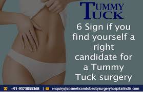6 Sign If You Find Yourself A Right Candidate For A Tummy Tuck Surgery Tummy Tuck Surgery Tummy Tucks C Section Belly