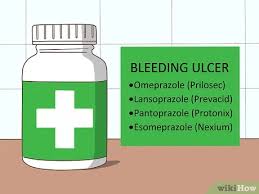 How do doctors treat peptic ulcer disease? How To Treat A Bleeding Ulcer 14 Steps With Pictures Wikihow