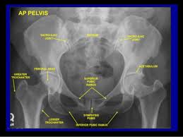 Knowledge of normal pelvic floor anatomy can aid the radiologist in understanding the complex nature of pelvic floor dysfunction and is important for comprehensive image interpretation. Radiographic Anatomy Of Abd And Pelvis R A