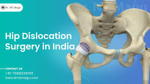 Image result for Hip Dislocation