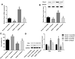 Currency converter to convert from romanian leu (ron) to euro (eur) including the latest exchange rates, a chart showing 1 ron is equal to 10,000 rol. Changqin No 1 Inhibits Neuronal Apoptosis Via Suppressing Gas5 Expression In A Traumatic Brain Injury Mice Model