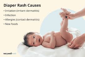 Image result for diaper dermatitis